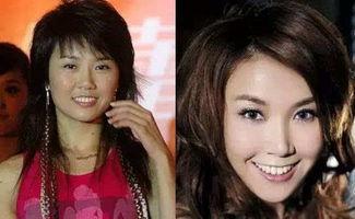 娱乐圈爆料整容,明星整容真相大揭秘！